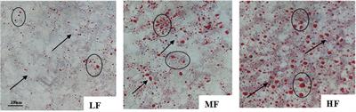 Lipid metabolism disorders of hybrid grouper (♀Epinephelus fuscointestinestatus × ♂E. lanceolatu) induced by high-lipid diet